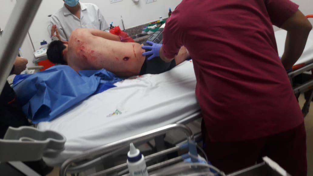 Un policía muerto y dos heridos tras operativo antinarcóticos Un policía muerto y dos heridos tras operativo antinarcóticos