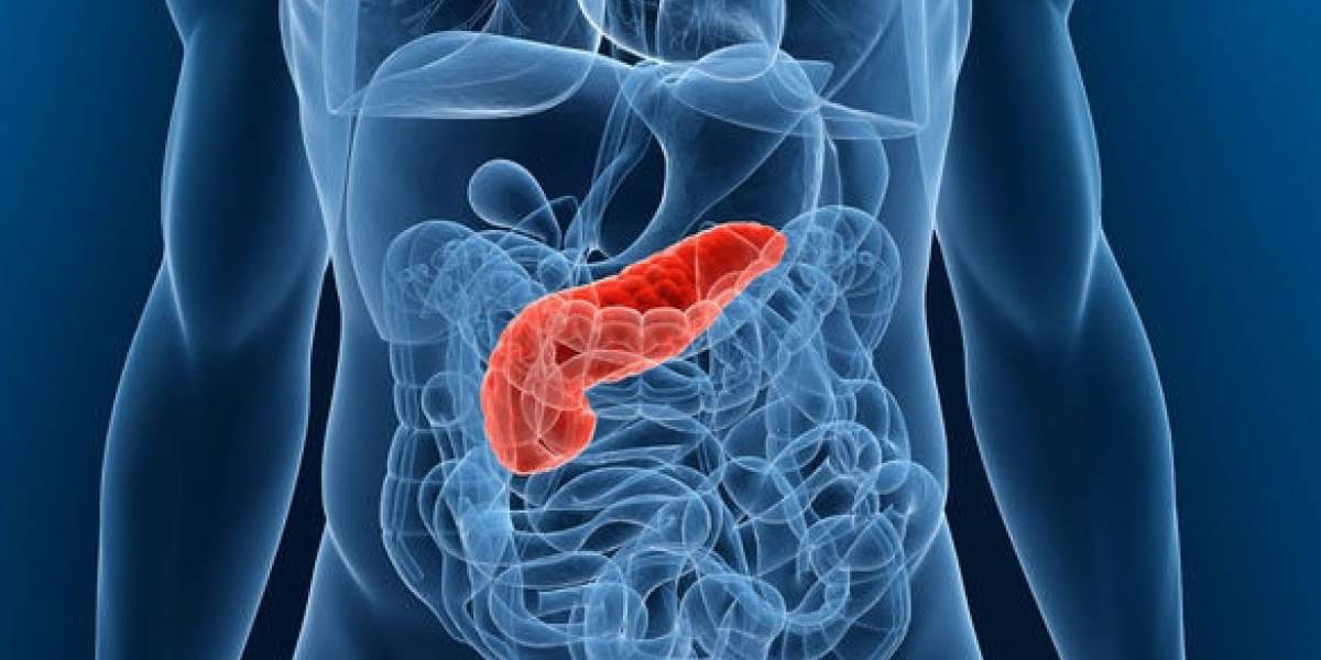 Logran descubrir la clave para enfrentar al temido cáncer de páncreas