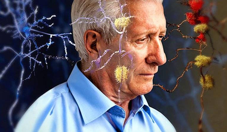 Alzheimer examen sangre