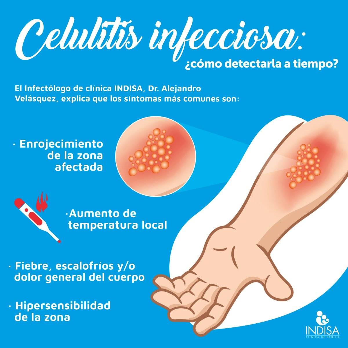 sobre celulitis y tratamiento