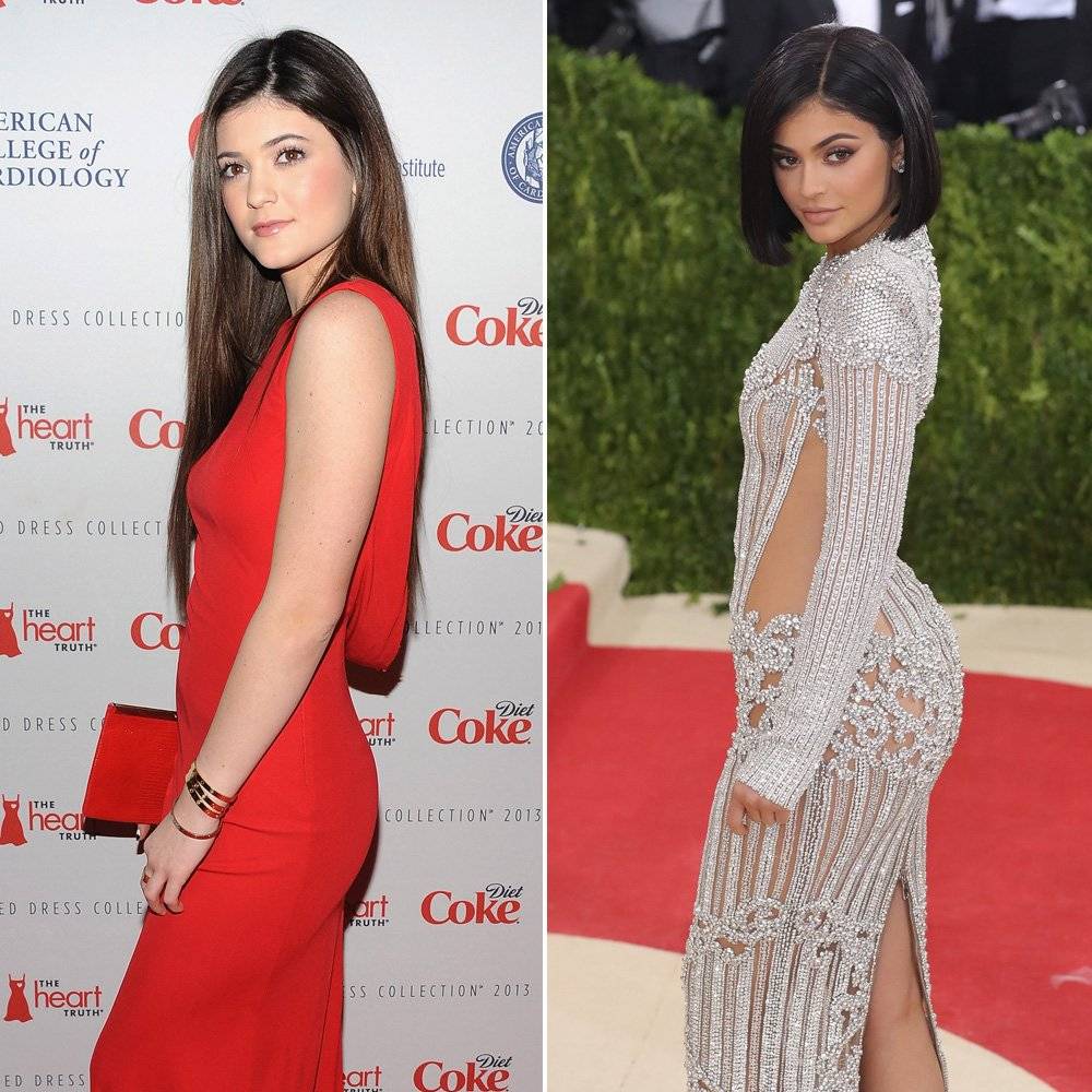 Kylie Jenner antes y después