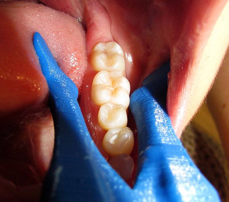Purple Dental