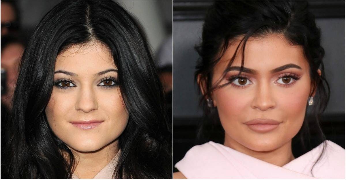 Kylie Jenner rostro
