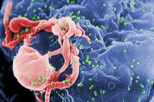 Británico se convierte en la segunda persona en ser curada de VIH