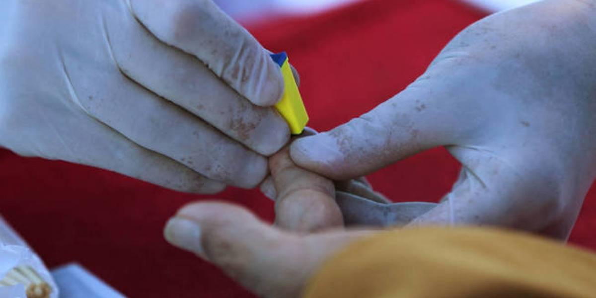 ¿La cura del sida? Se reporta segundo caso de paciente que se libra del VIH