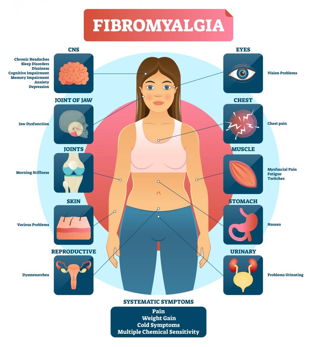 Fibromialgia