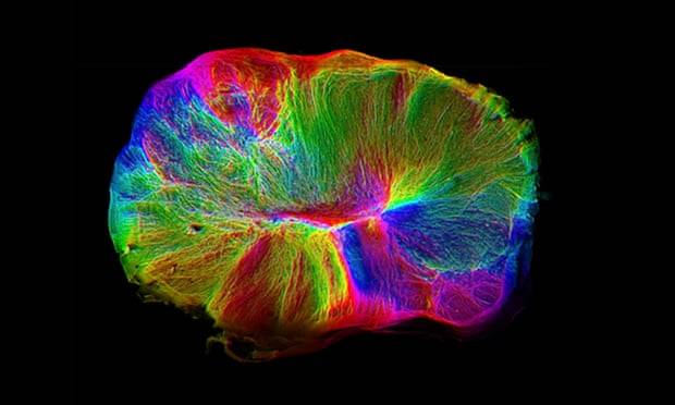 Cerebro Cerebro