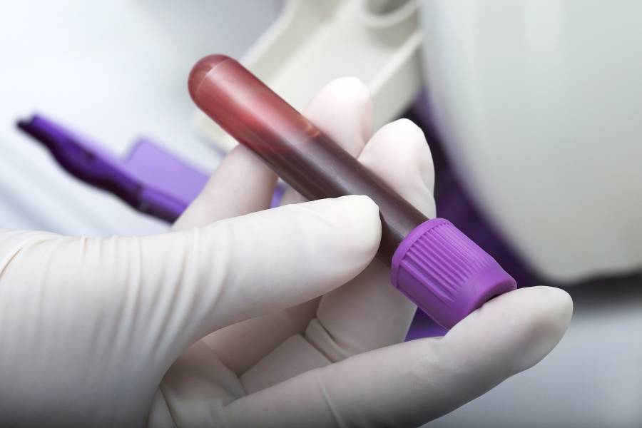 Sangre en determina que creatinina la