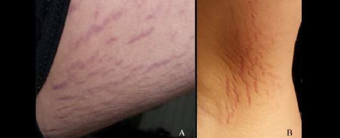 Un gato habría sido el culpable de un misterioso caso de esquizofrenia y alucinaciones en un niño de 14 años Un gato habría sido el culpable de un misterioso caso de esquizofrenia y alucinaciones en un niño de 14 años