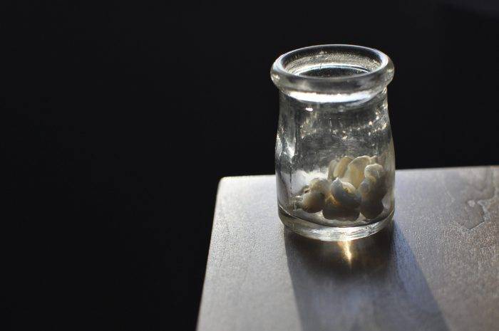 Dientes de leche podrían salvar la vida de tu hijo, según estudios Dientes de leche podrían salvar la vida de tu hijo, según estudios