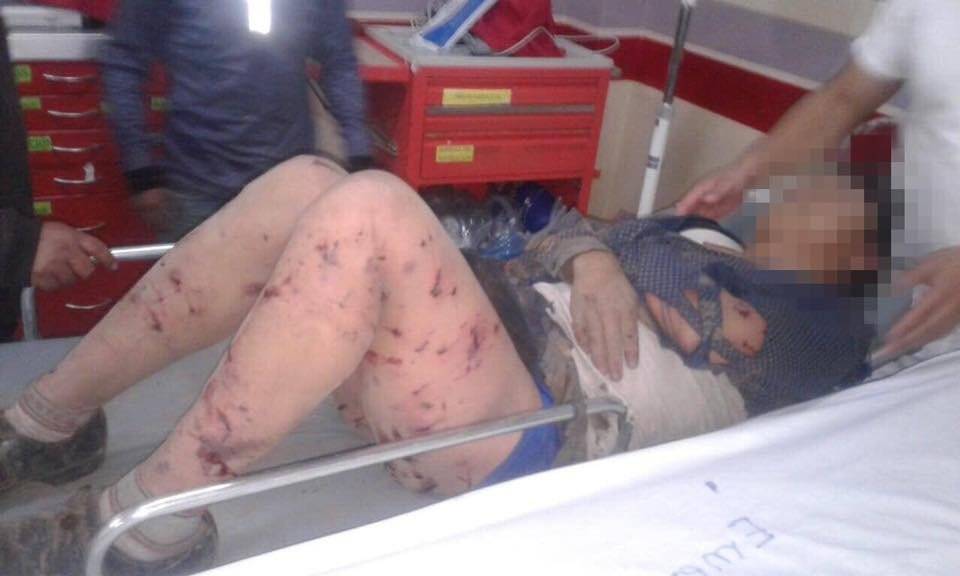 Hombre mordido por perros