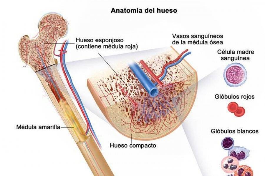 Encias leucemia