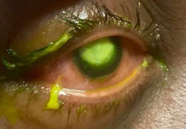 ojo