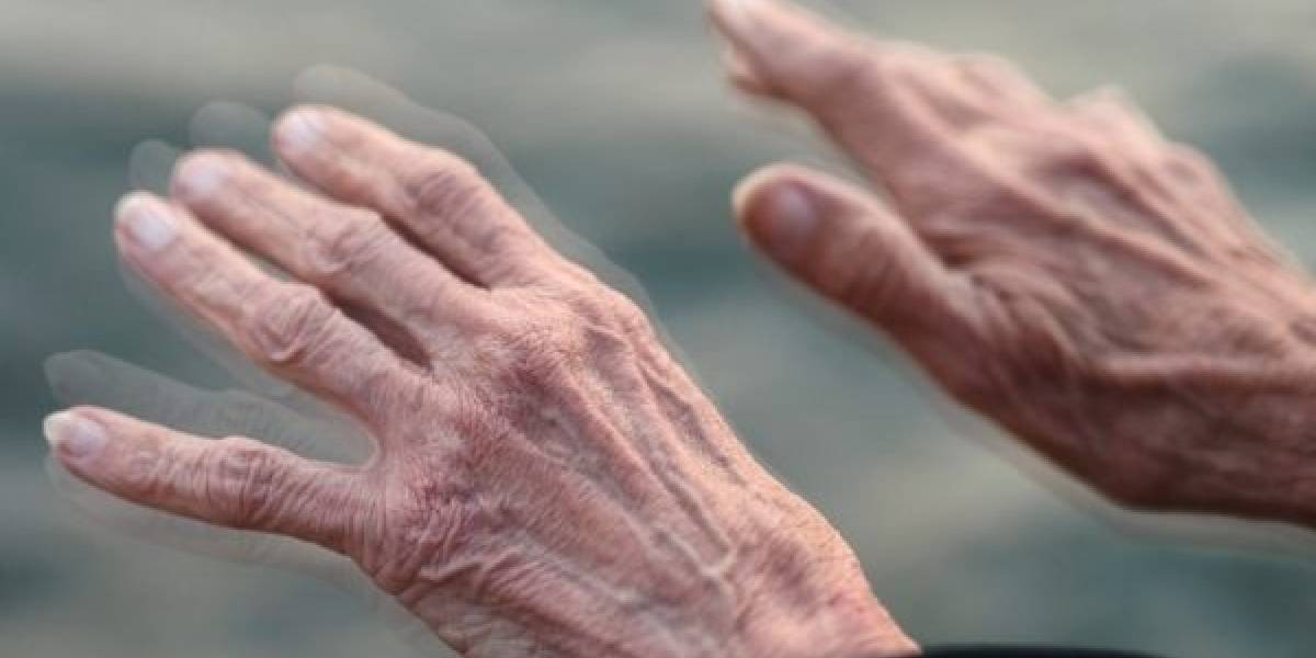 El tratamiento parkinson contra de natural mal