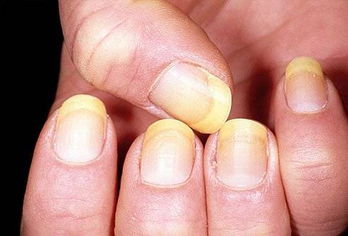 unhas