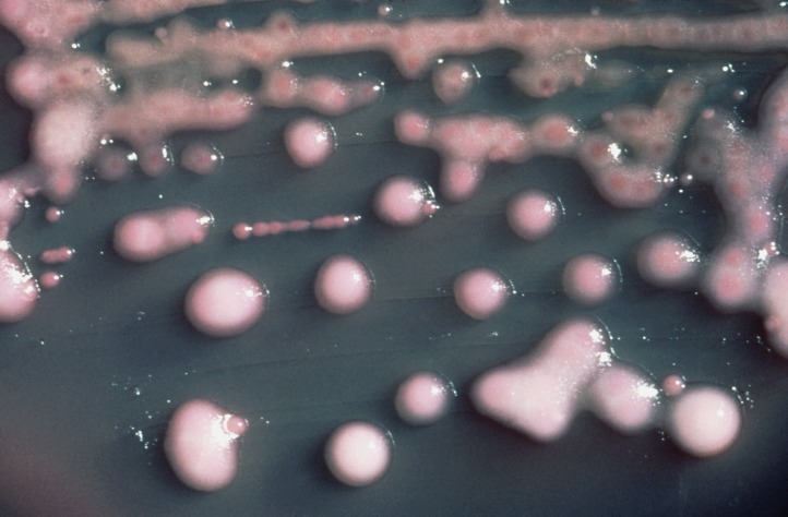 Estos son cinco de los aterradores tipos de bacterias más resistentes a los antibióticos en los últimos años Estos son cinco de los aterradores tipos de bacterias más resistentes a los antibióticos en los últimos años