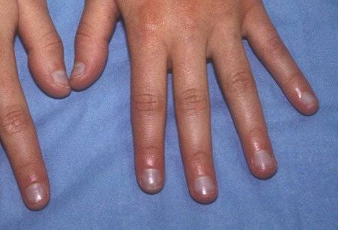 unhas