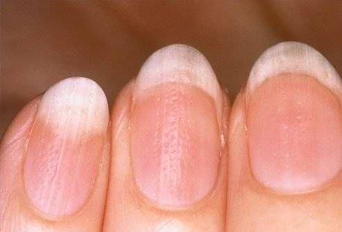 unhas