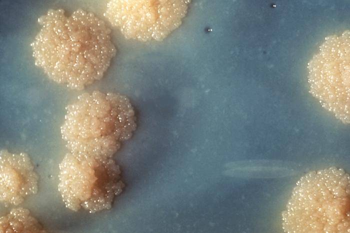 Tuberculosis Tuberculosis