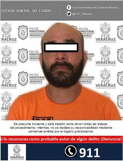 El Pelón