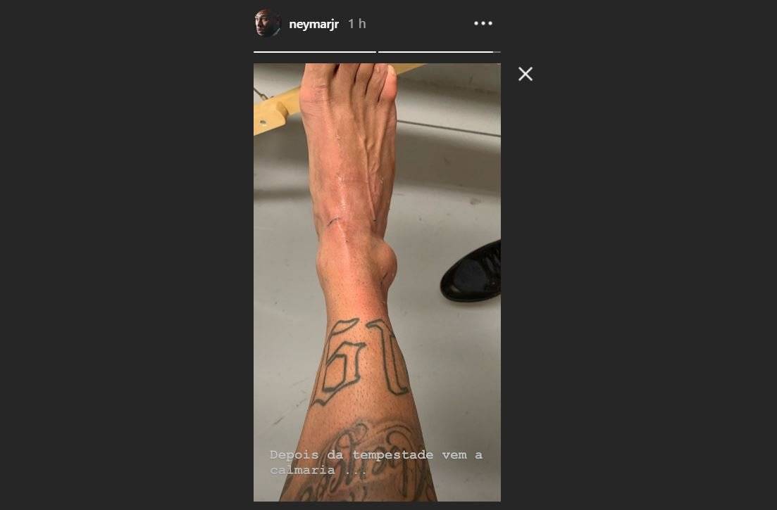 Neymar