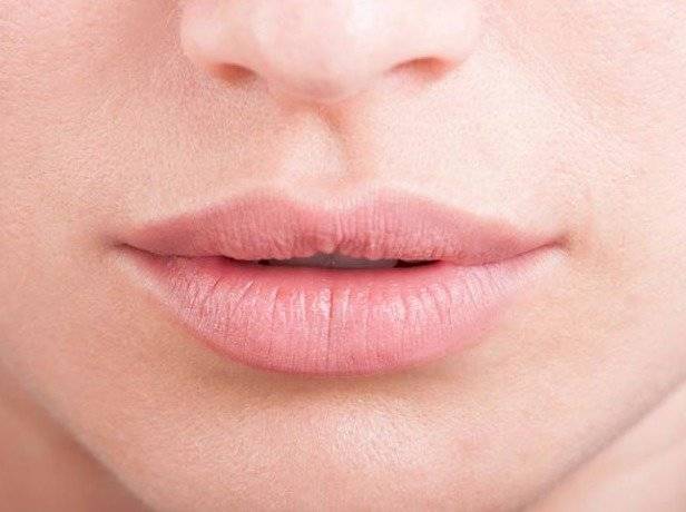 Labios