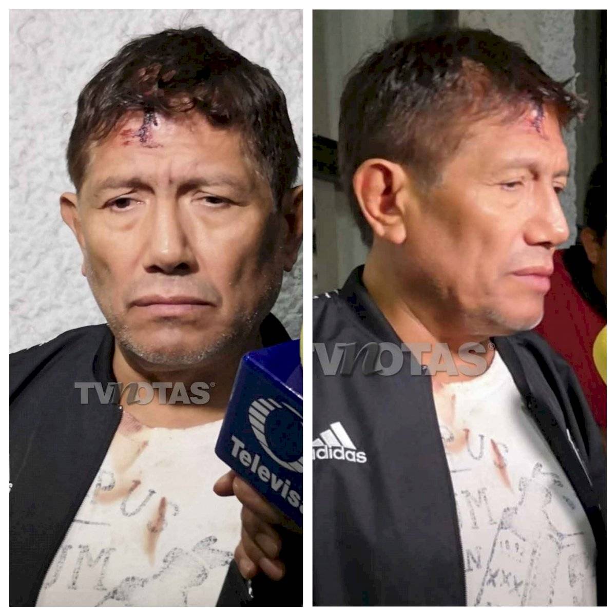 Juan Osorio golpeado