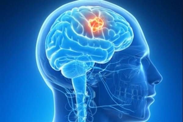 tumor