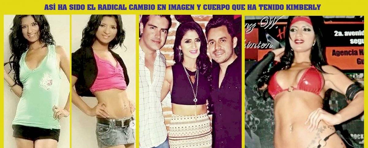 Antes y después de Kim Flores
