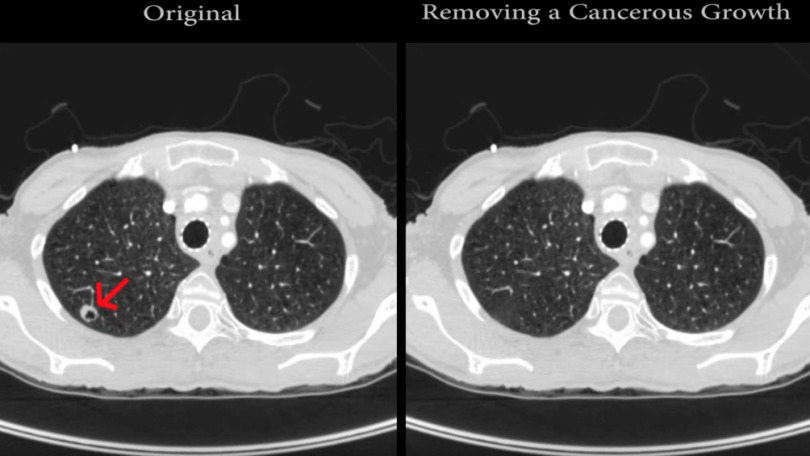 Grave: Investigadores logran alteran diagnósticos de pacientes de cáncer a través de hacking Grave: Investigadores logran alteran diagnósticos de pacientes de cáncer a través de hacking