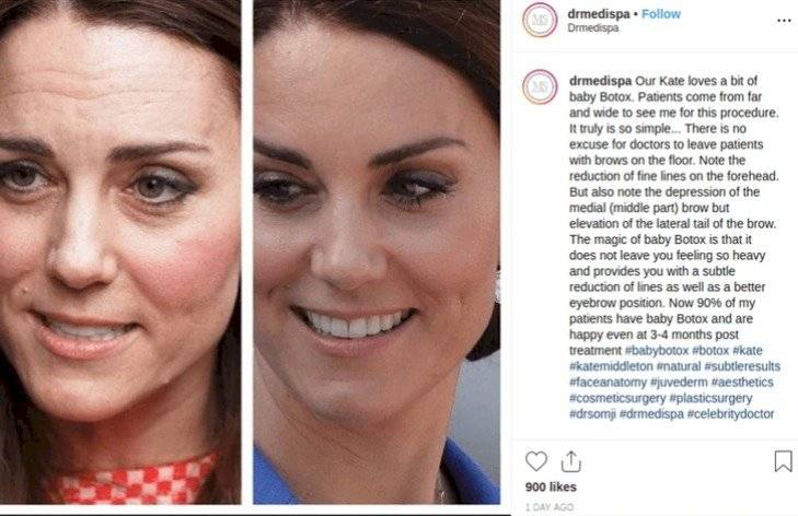 Kate Middleton