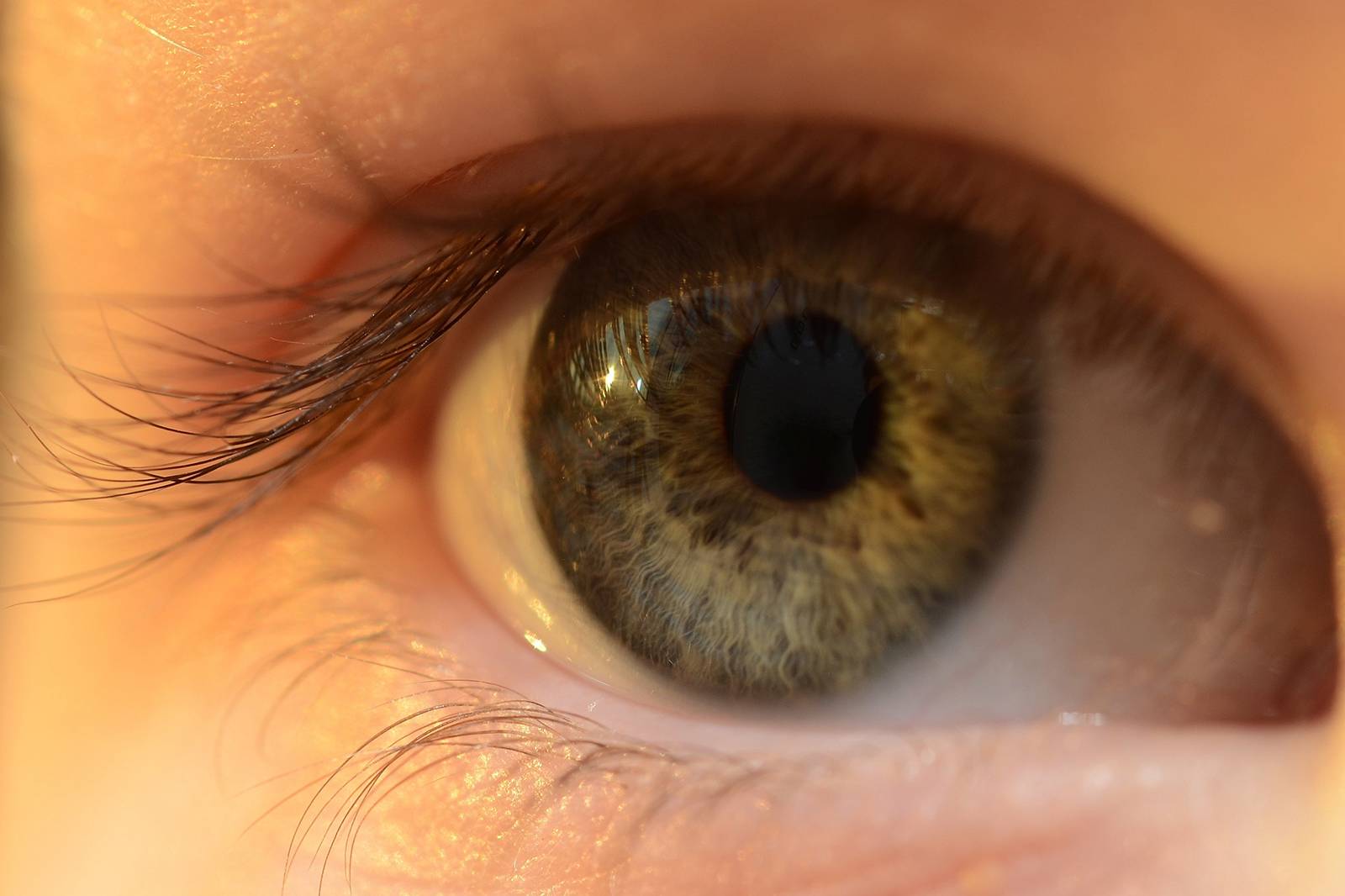 lentes de contacto lentes de contacto