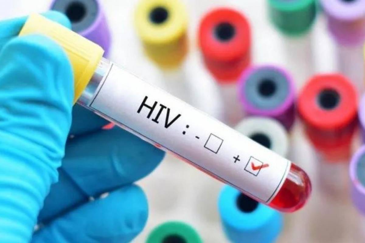 Síntomas del Sida | Nueva Mujer