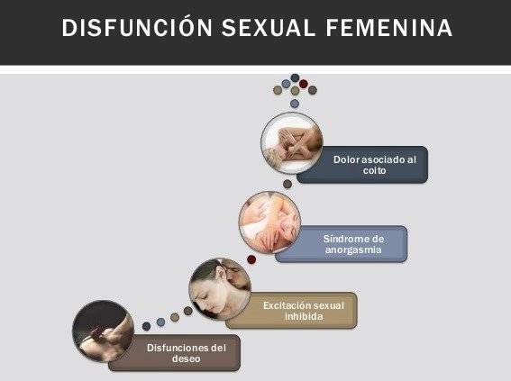 disfunción femenina