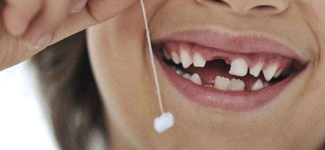 dientes de leche