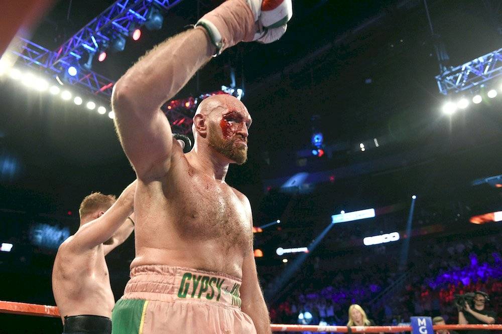 Tyson Fury