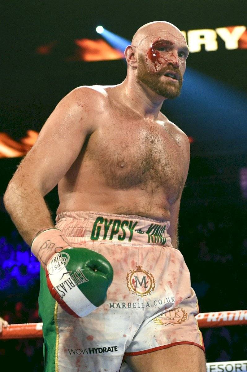 Tyson Fury