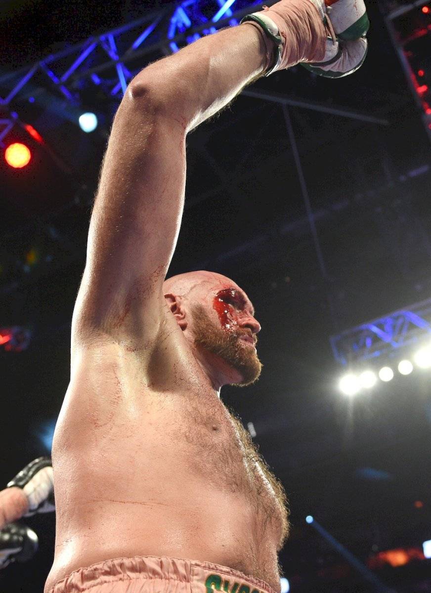 Tyson Fury