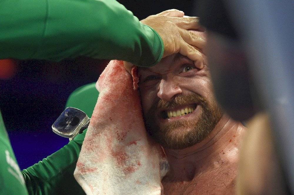 Tyson Fury