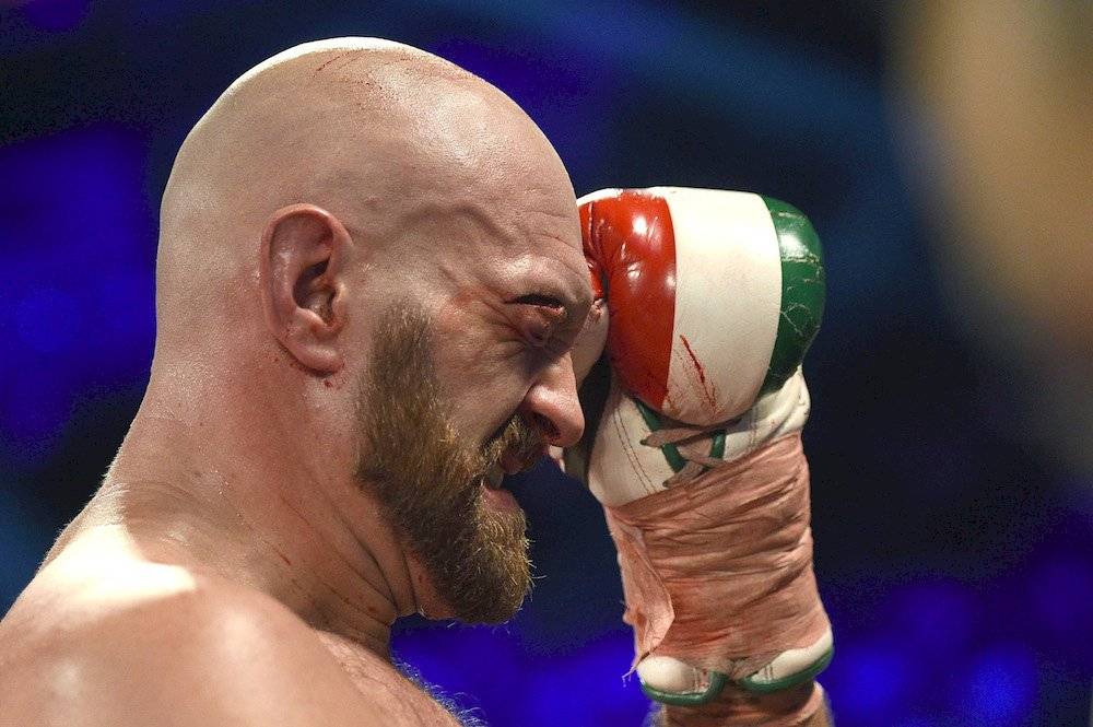 Tyson Fury
