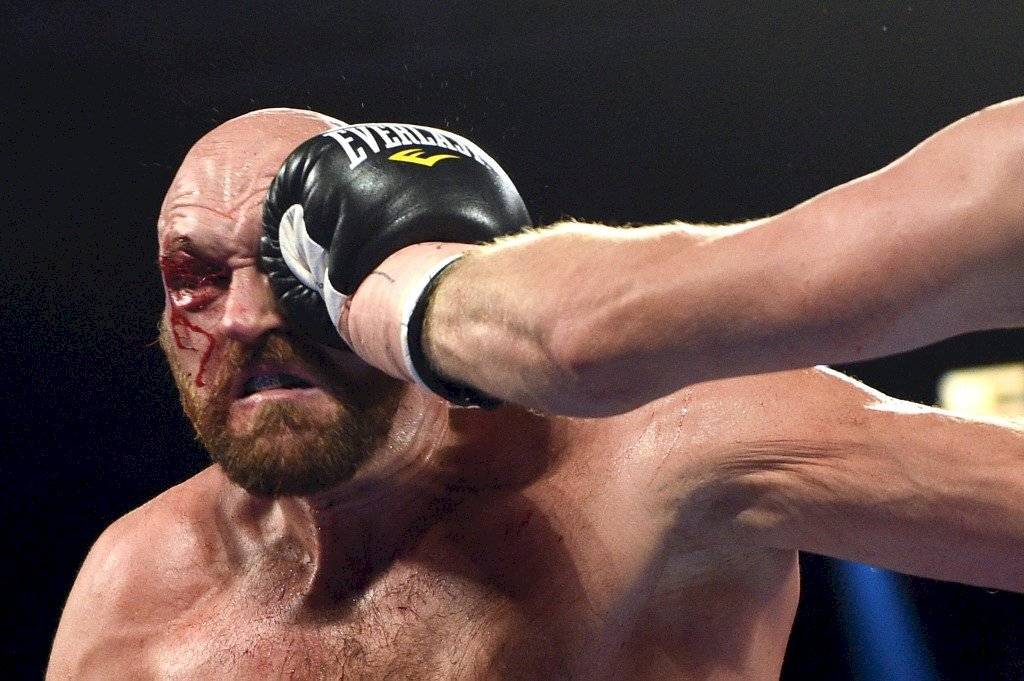 Tyson Fury sangrienta pelea Otto Wallin