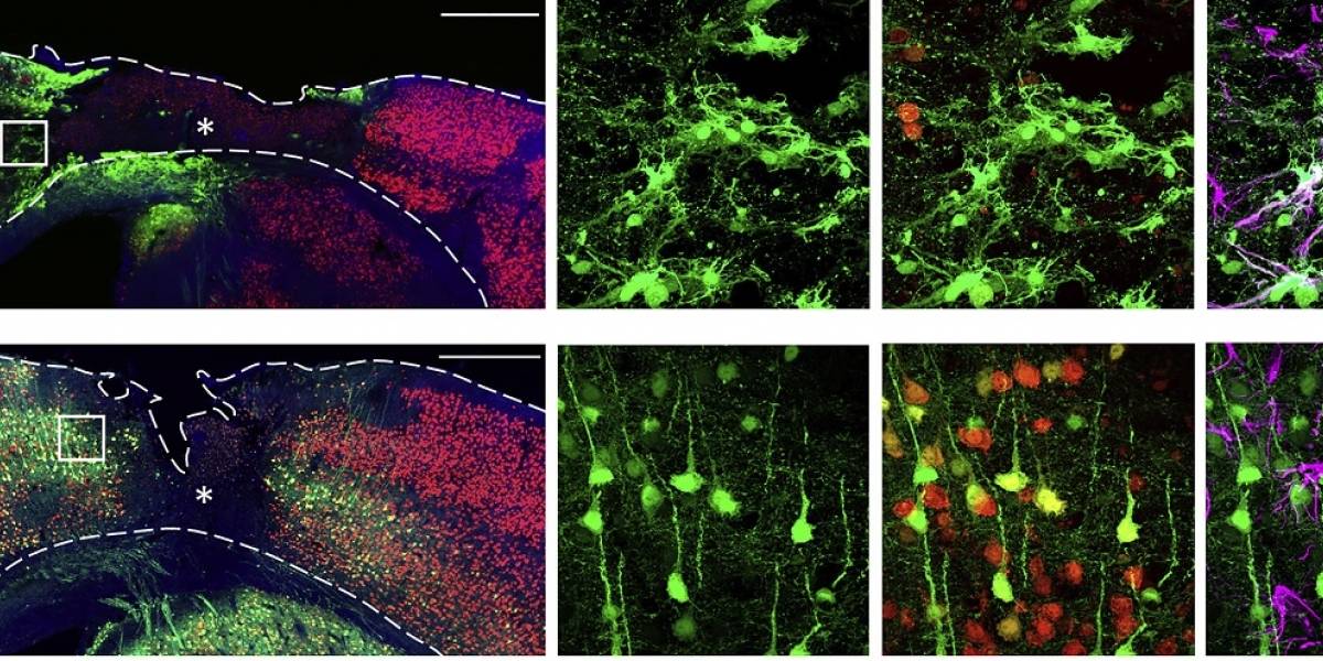Prueban con éxito terapia génica para regenerar las neuronas pérdidas en accidentes cerebro vasculares