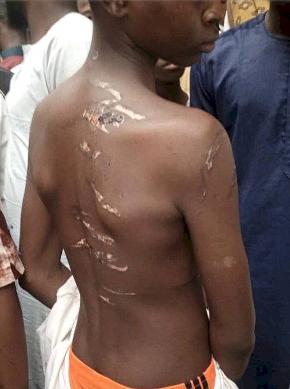 Marcas del maltrato que eran víctimas cientos de niños