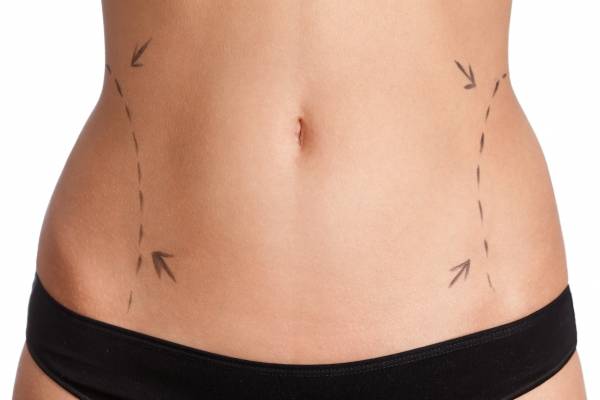lipo