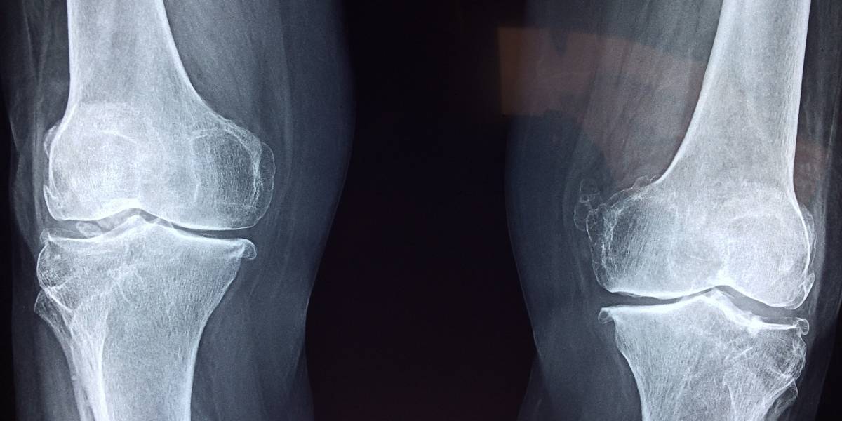 Los humanos tienen la capacidad de regenerar cartílago de forma similar a las salamandras