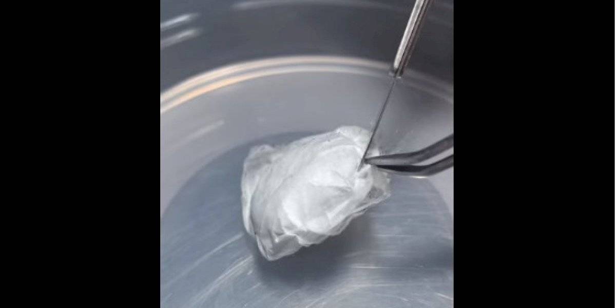 Video De Abertura De Saco De Ovos Da Aranha Mais Venenosa Da Australia Se Torna Viral Nas Redes Sociais Metro Jornal