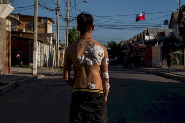 Protestas en Chile
