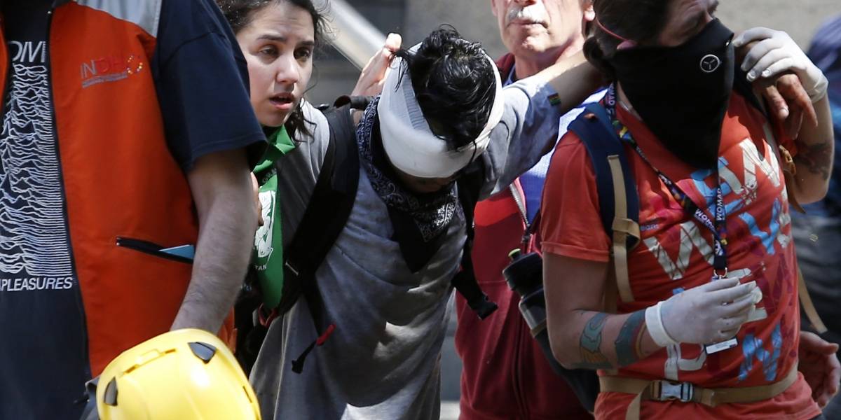 Cifra de daños oculares sin precedentes: perdigones y balines son culpables de que Chile viva peor crisis oftalmológica mundial en 30 años