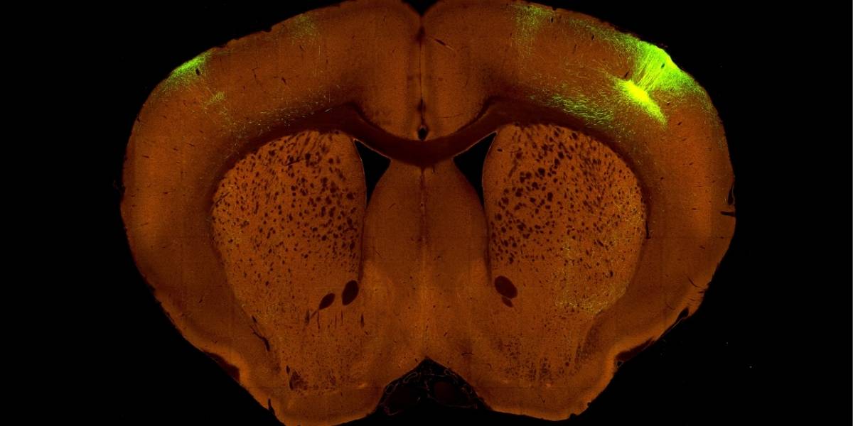 Este es el mapa más detallado de las conexiones de un cerebro