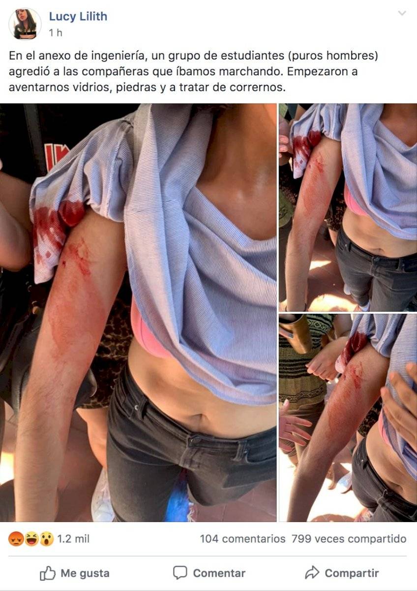 Estudiante herida en manifestación
